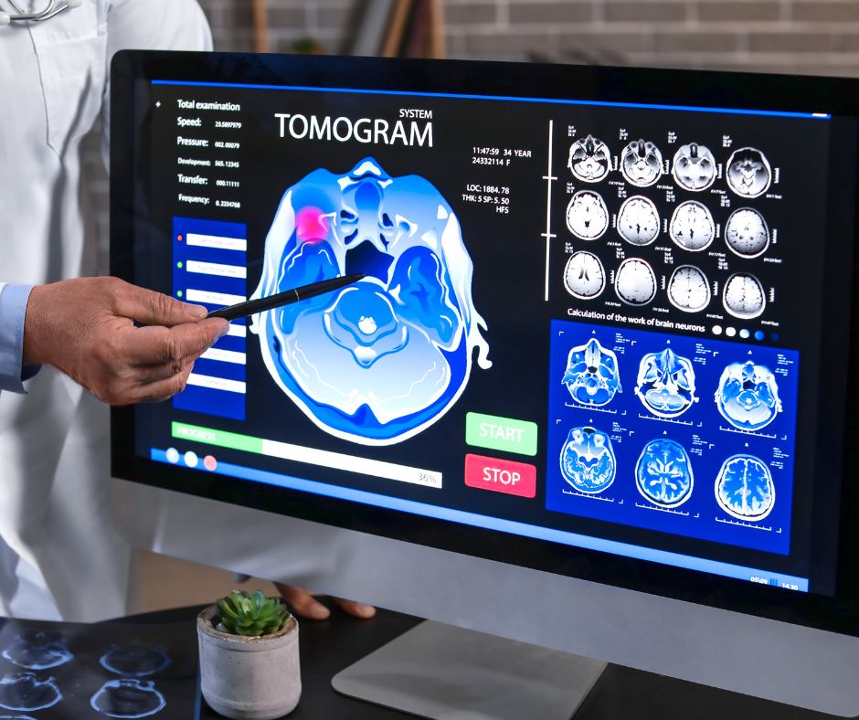 Predictive Analytics and AI in Healthcare: Using AI to Predict Patient Outcomes